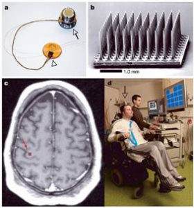 braingate machine | एलन मस्क की न्यूरोलिंक तकनीक (NeuraLink Technology in Hindi)