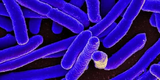 Space Grown E Coli bacteria