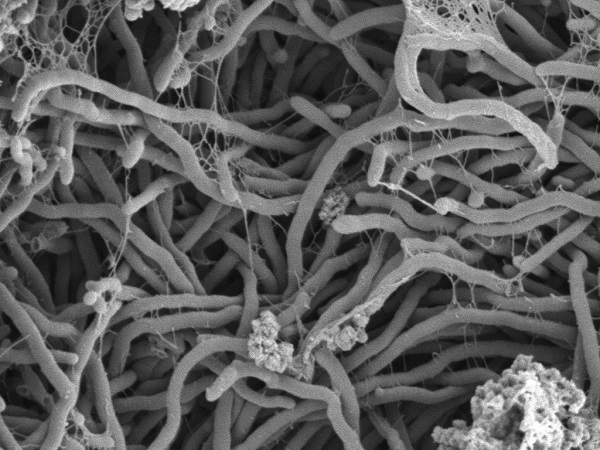 Mud giant- Streptomyces.