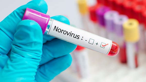 Undergoing studies on norovirus.