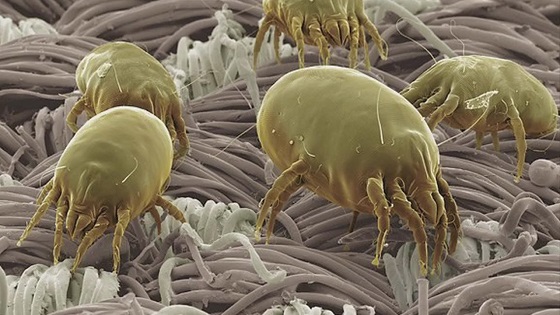 Photo of Dust Mites.