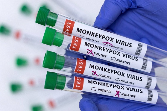 मंकीपॉक्स वायरस के बारे में पूरी जानकारी - Monkeypox Virus In Hindi.