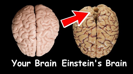 Comparison between normal vs einstein brain.