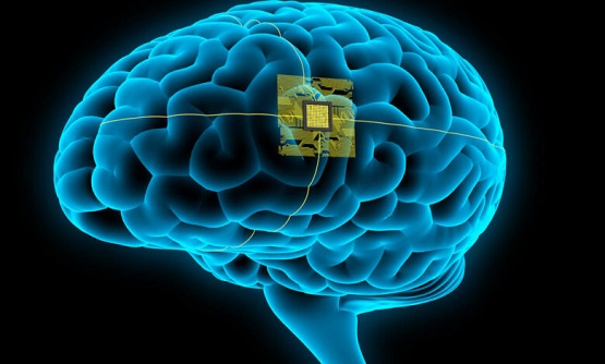 जल्द ही इंसान बनने वाला हैं रोबॉट! - 1st Neuralink Brain Chip Implanted!