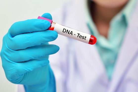 डीएनए परीक्षण वाकई में कैसे की जाती हैं? - How DNA Testing Really Works?